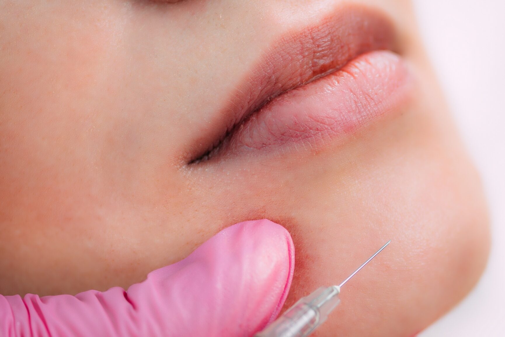 Dermal Filler Injection for Chin