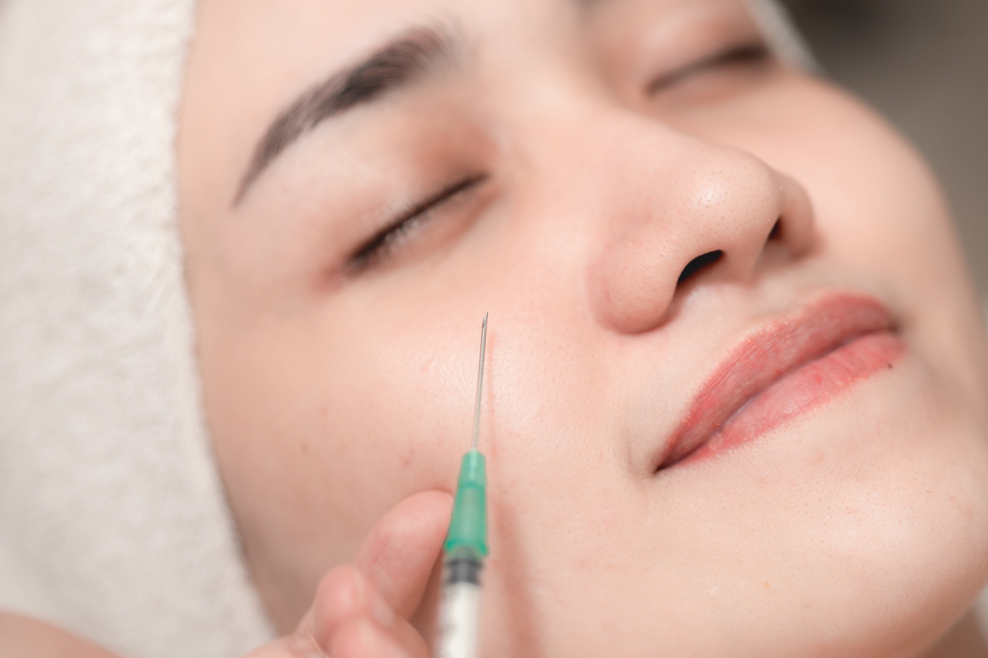 Woman needle injection facelift. Medical Filler for face lifting remove wrinkles